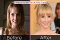 Melissa Rauch Plastic Surgery Before and After